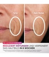 Produktbild 3 von 6, Shark CryoGlow Lichttherapiegerät