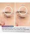 Produktbild 4 von 6, Shark CryoGlow Lichttherapiegerät