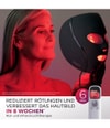 Produktbild 6 von 6, Shark CryoGlow Lichttherapiegerät
