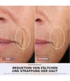 Produktbild 3 von 6, Shark CryoGlow Lichttherapiegerät
