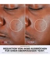 Produktbild 5 von 6, Shark CryoGlow Lichttherapiegerät