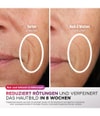 Produktbild 5 von 6, Shark CryoGlow Lichttherapiegerät