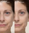 Produktbillede 2 af 6, Peter Thomas Roth Instant FirmX Primer