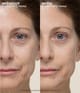 Produktbild 2 von 6, Peter Thomas Roth Instant FirmX Primer