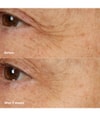 Produktbild 6 von 6, CLINIQUE Smart Clinical Repair Gesichtsmaske