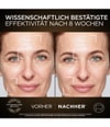 Produktbillede 5 af 6, L'Oréal Paris Age Perfect Natcreme