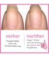 Immagine prodotto 5 di 6, essie Hard to resist Rinforzante per unghie