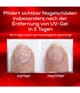 Produktbild 4 von 6, essie To the rescue Nagelhärter