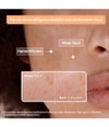 Productafbeelding 4 van 6, Mixa Anti-pigmentvlekken Serum
