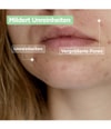 Produktbild 4 von 6, Mixa Anti-Unreinheiten Reinigungsgel
