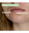 Produktbild 4 von 6, Mixa Anti-Unreinheiten Gesichtsgel