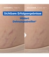 Produktbild 4 von 6, Mixa Stretch Mark Oil Körperöl
