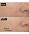 Produktbillede 5 af 6, Kiehl's Powerful-Strength Serum