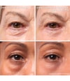 Immagine prodotto 2 di 6, IT Cosmetics Bye Bye Under Eye Crema per il contorno occhi