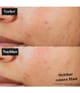 Produktbillede 5 af 6, Kiehl's Expertly Clear Ansigtslotion