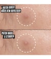 Productafbeelding 4 van 6, Kiehl's Truly Targeted Pimple Patches