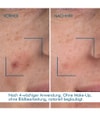 Produktbild 6 von 6, BIOTHERM Blue Therapy Gesichtsserum