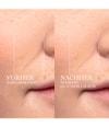 Produktbild 3 von 6, LANCÔME Rénergie Gesichtsserum