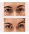 Produktbillede 6 af 6, PARSA Beauty Augen-/ Schlupflidtapes Øjenlågstape