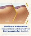 Productafbeelding 4 van 6, NIVEA Luminous W630 Lichaamsolie
