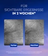 Produktbild 6 von 6, NIVEA Cellular Epicelline Gesichtsserum