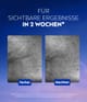 Produktbillede 6 af 6, NIVEA Cellular epicelline Serum