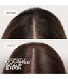 Productafbeelding 2 van 6, Goldwell Dualsenses Scalp Specialist Shampoo