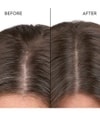 Produktbillede 3 af 6, Kerasilk Anti-Dandruff Shampoo Shampoo