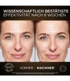 Produktbild 2 von 6, L'Oréal Paris Age Perfect Gesichtspflegeset