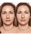 Produktbillede 5 af 6, CATRICE True Skin Concealer