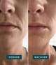 Produktbild 3 von 5, APRICOT Wiederverwendbare Mund Pads Lippenpad