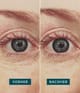 APRICOT Wiederverwendbare Augen Pads Augenpads 2 Stk 4260543571610 detail-shot_de