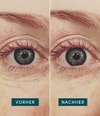 Image du produit 3 sur 5, APRICOT Coussinets réutilisables pour les yeux Patch yeux