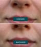 Produktbild 3 von 5, APRICOT keep smiling Gesichtsmaske