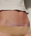 Produktbild 2 von 5, APRICOT Wiederverwendbare Narben Pads Silikonpad