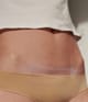 Produktbild 2 von 5, APRICOT Wiederverwendbare Narben Pads Silikonpad