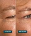 Produktbild 3 von 5, APRICOT Wiederverwendbare Augen-Schläfen Pads Augenpads