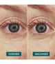 Produktbild 3 von 5, APRICOT Wiederverwendbare Augen Pads Augenpads