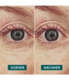 Produktbild 3 von 5, APRICOT Wiederverwendbare Augen Pads Augenpads
