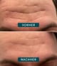 Productafbeelding 3 van 5, APRICOT Gezichtspleisters Gezichtsmasker
