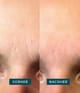 APRICOT Gesicht Patches Gesichtsmaske 100 Stk 4260543571207 detail-shot_de