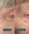 Produktbild 3 von 5, APRICOT Wiederverwendbare Augen-Schläfen Pads Augenpads