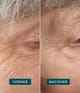 Produktbild 3 von 5, APRICOT Wiederverwendbare Augen-Schläfen Pads Augenpads
