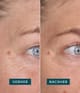 Produktbild 3 von 5, APRICOT Wiederverwendbare Augen-Schläfen Pads Silikonpad