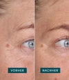 Produktbild 3 von 5, APRICOT Wiederverwendbare Augen-Schläfen Pads Silikonpad