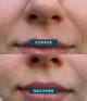 Produktbild 3 von 5, APRICOT Mund Patches Lippenpad