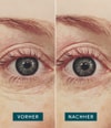 Produktbild 3 von 5, APRICOT Wiederverwendbare Augen Pads Augenpads