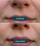 Produktbild 3 von 5, APRICOT Mund Patches Lippenpad