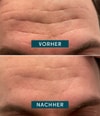 Produktbild 3 von 5, APRICOT Gesicht Patches Gesichtsmaske