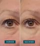 Produktbild 3 von 5, APRICOT Wiederverwendbare Augen-Schläfen Pads Silikonpad